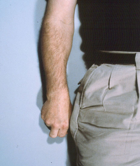 7 Signs a Weapon Is Being Concealed, slide 9