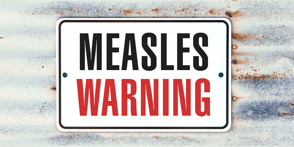 Measles Outbreak